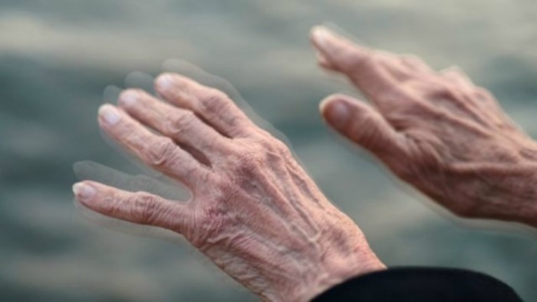 Parkinson hastalığı nedir? Parkinson hastalığının nedenleri ve belirtileri nelerdir?