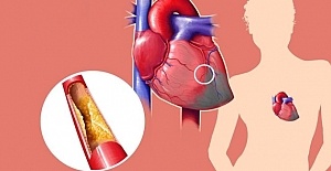 Kolesterol Hakkında 8 Şaşırtıcı Gerçek