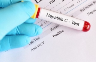 Hepatit C Belirtileri ve Uyarı İşaretleri